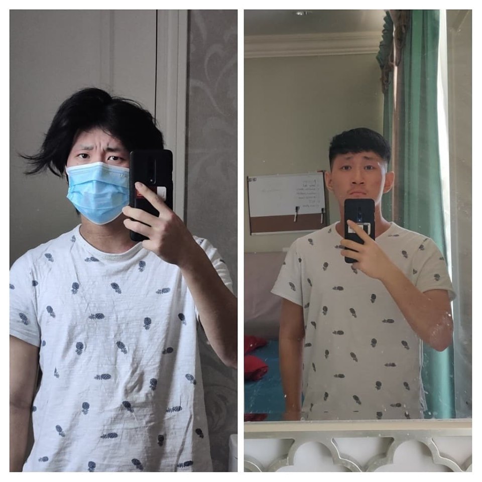 The paradox of  “Normal”